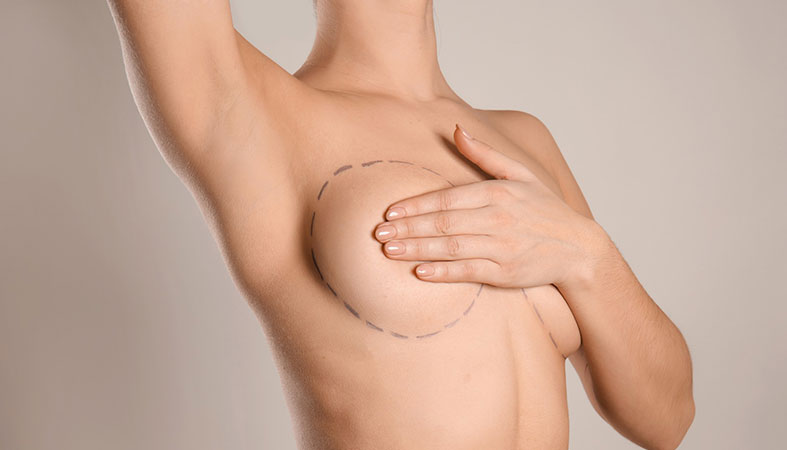 How to Choose the Right Breast Implants?