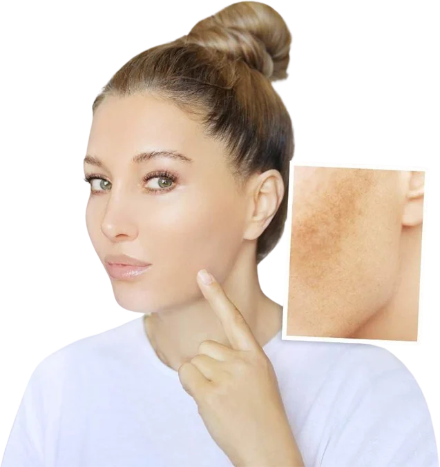 Skin Pigmentation Treatment Sydney NSW Dr. Adam Najem